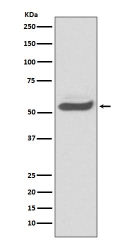 Anti-SERPINA1/Alpha 1 Antitrypsin Rabbit Monoclonal Antibody Boster Bio
