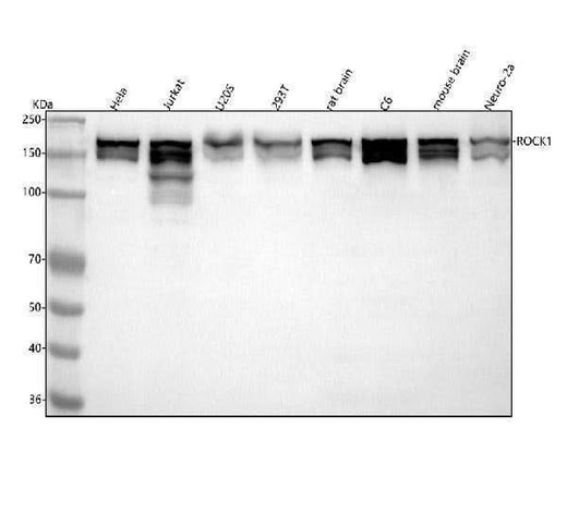 Anti-ROCK1 Rabbit Monoclonal Antibody Boster Bio