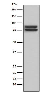 Anti-FOXP1 Monoclonal Antibody Boster Bio