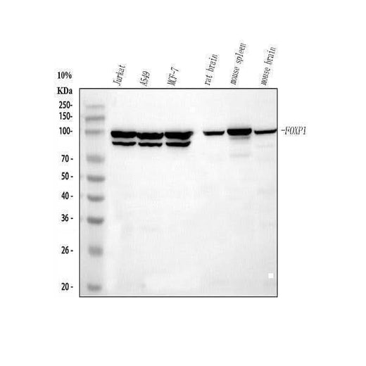 Anti-FOXP1 Rabbit Monoclonal Antibody Boster Bio
