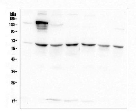 Anti-AKT2 Antibody Picoband® (monoclonal, 10C6 Boster Bio