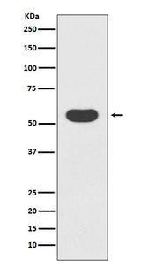Anti-Smad1 Rabbit Monoclonal Antibody Boster Bio