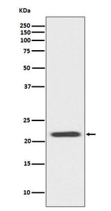 Anti-Bid Rabbit Monoclonal Antibody Boster Bio