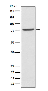 Anti-Mre11 MRE11A Rabbit Monoclonal Antibody Boster Bio