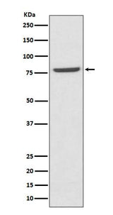 Anti-Mre11 MRE11A Rabbit Monoclonal Antibody Boster Bio