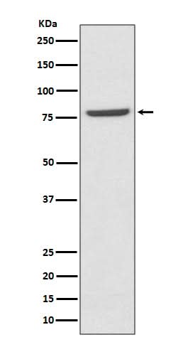 Anti-Mre11 MRE11A Rabbit Monoclonal Antibody Boster Bio