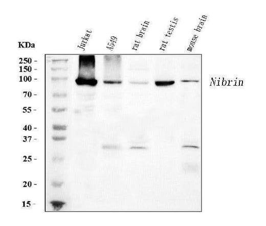 Anti-p95 NBS1 Antibody Picoband® (monoclonal, 5D7A1 Boster Bio
