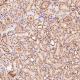 Anti-p95/NBS1 NBN Rabbit Monoclonal Antibody Boster Bio