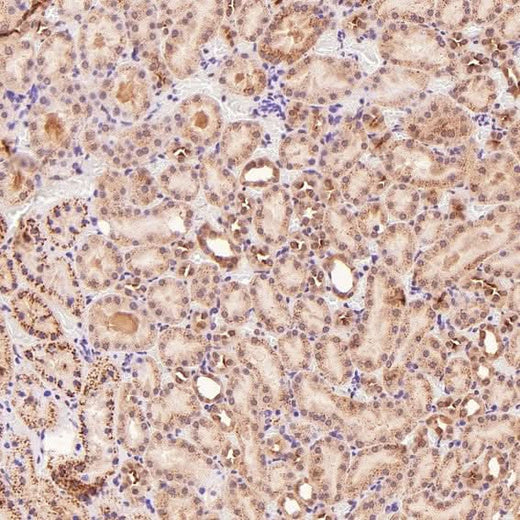 Anti-p95/NBS1 NBN Rabbit Monoclonal Antibody Boster Bio