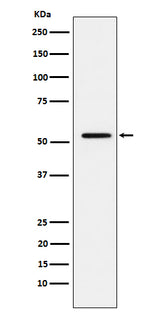 Anti-MMP1 Rabbit Monoclonal Antibody Boster Bio
