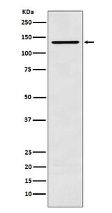 Anti-CARD11 Rabbit Monoclonal Antibody Boster Bio
