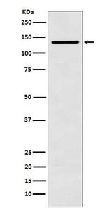 Anti-CARD11 Rabbit Monoclonal Antibody Boster Bio