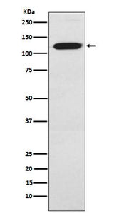 Anti-Ctip1 Monoclonal Antibody Boster Bio