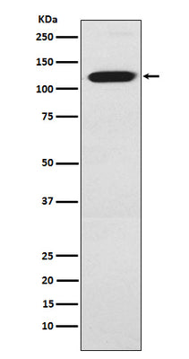 Anti-Ctip1 Monoclonal Antibody Boster Bio