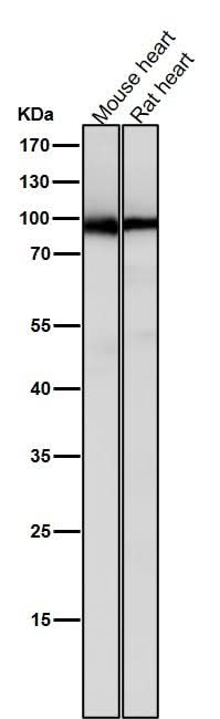 Anti-PKC Rabbit Monoclonal Antibody Boster Bio