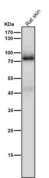Anti-PKC Rabbit Monoclonal Antibody Boster Bio