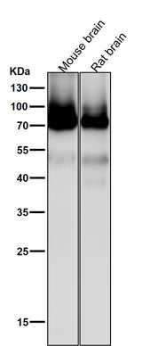 Anti-PKC Rabbit Monoclonal Antibody Boster Bio