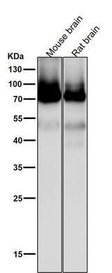 Anti-PKC Rabbit Monoclonal Antibody Boster Bio