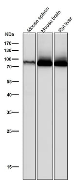Anti-PKC Rabbit Monoclonal Antibody Boster Bio