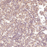 Anti-PKC alpha PRKCA Rabbit Monoclonal Antibody Boster Bio