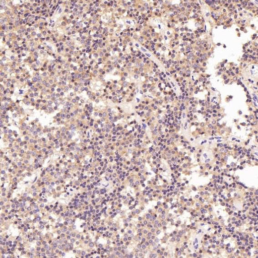 Anti-PKC alpha PRKCA Rabbit Monoclonal Antibody Boster Bio