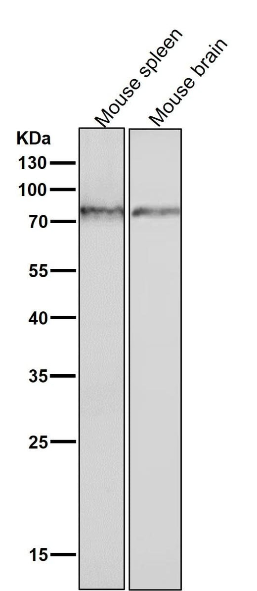Anti-Phospho-PKC (S729) Rabbit Monoclonal Antibody Boster Bio