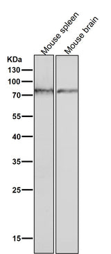 Anti-Phospho-PKC (S729) Rabbit Monoclonal Antibody Boster Bio