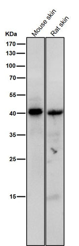 Anti-Phospho-PKA C (Thr197) Rabbit Monoclonal Antibody Boster Bio
