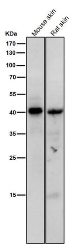 Anti-Phospho-PKA C (Thr197) Rabbit Monoclonal Antibody Boster Bio