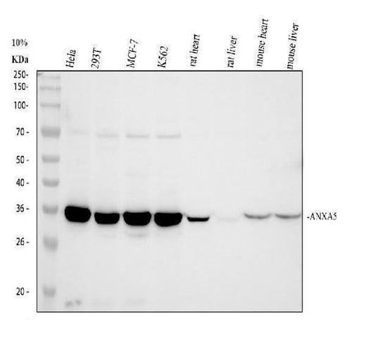 Anti-Annexin V ANXA5 Rabbit Monoclonal Antibody Boster Bio