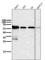 Anti-Cyclin B1 CCNB1 Rabbit Monoclonal Antibody Boster Bio