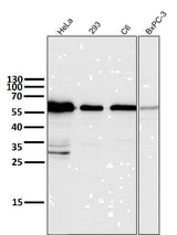 Anti-Cyclin B1 CCNB1 Rabbit Monoclonal Antibody Boster Bio
