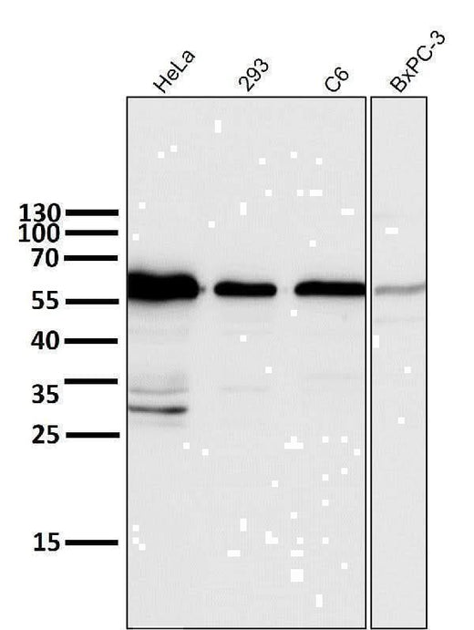 Anti-Cyclin B1 CCNB1 Rabbit Monoclonal Antibody Boster Bio