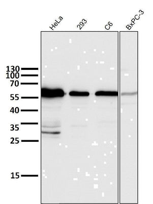 Anti-Cyclin B1 CCNB1 Rabbit Monoclonal Antibody Boster Bio