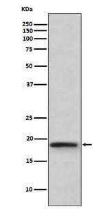 Anti-TNF beta Rabbit Monoclonal Antibody Boster Bio