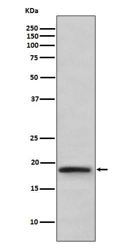 Anti-TNF beta Rabbit Monoclonal Antibody Boster Bio