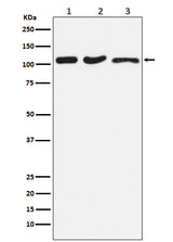 Anti-DISC1 Rabbit Monoclonal Antibody Boster Bio