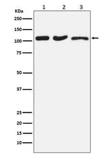 Anti-DISC1 Rabbit Monoclonal Antibody Boster Bio