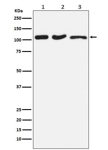 Anti-DISC1 Rabbit Monoclonal Antibody Boster Bio