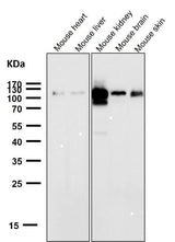 Anti-ACE2 Rabbit Monoclonal Antibody Boster Bio