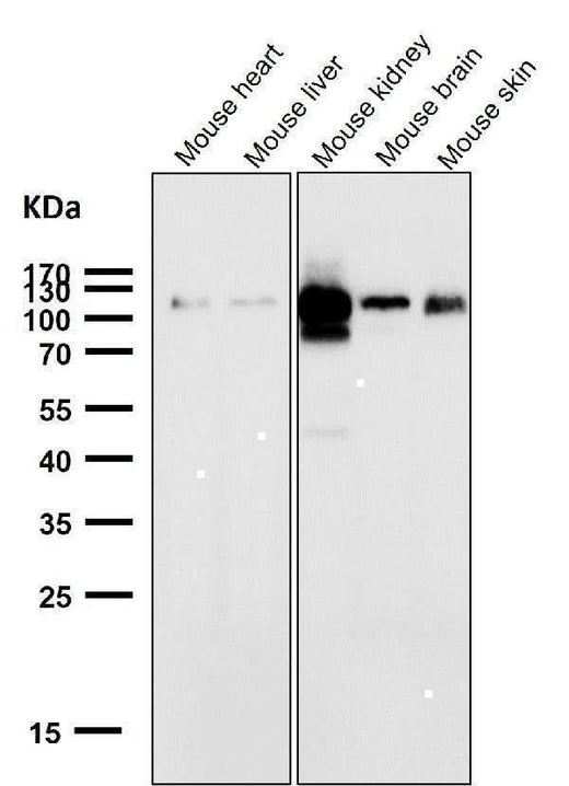 Anti-ACE2 Rabbit Monoclonal Antibody Boster Bio