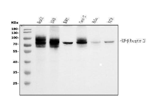 Anti-TGFBR2 Antibody Picoband® (monoclonal, 2F11 Boster Bio