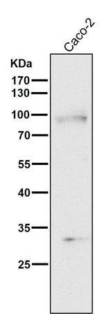 Anti-TGF beta Receptor II TGFBR2 Rabbit Monoclonal Antibody Boster Bio