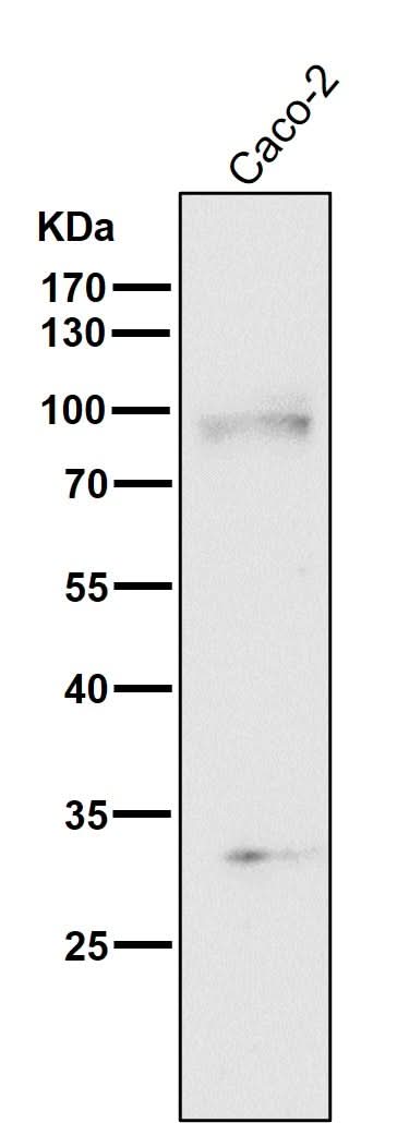 Anti-TGF beta Receptor II TGFBR2 Rabbit Monoclonal Antibody Boster Bio