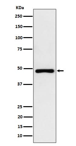 Anti-PAH Rabbit Monoclonal Antibody Boster Bio