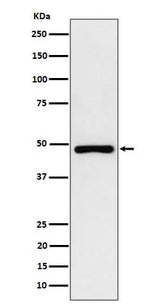 Anti-PAH Rabbit Monoclonal Antibody Boster Bio
