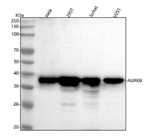 Anti-Aurora B AURKB Rabbit Monoclonal Antibody Boster Bio
