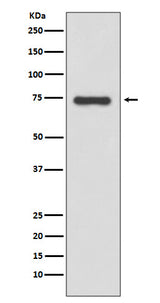 Anti-Moesin Rabbit Monoclonal Antibody Boster Bio