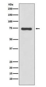 Anti-Moesin Rabbit Monoclonal Antibody Boster Bio