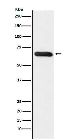 Anti-RBPJK Monoclonal Antibody Boster Bio